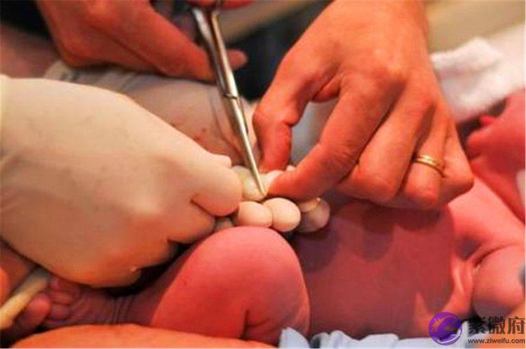 孩子刚出生剪脐带时，是妈妈疼还是宝宝疼？很多人还不知道