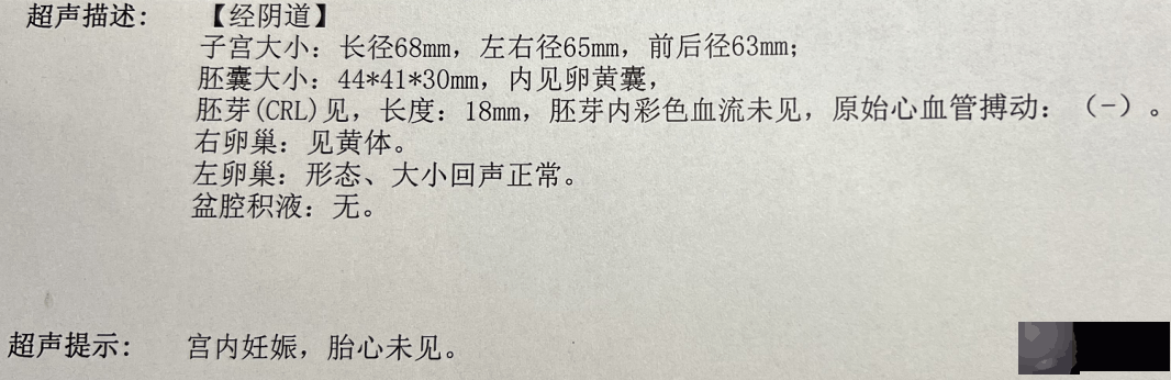验孕棒“两条杠”，竟然没怀孕？这个检查一定要做