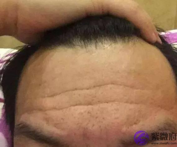 女人额头上长出“三条杠”，你们知道说明什麽吗