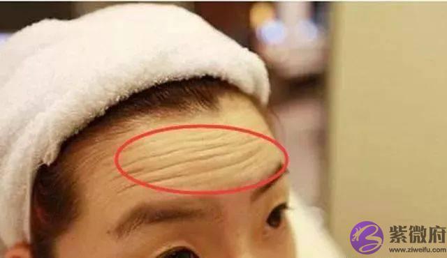 女人额头上长出“三条杠”，你们知道说明什麽吗