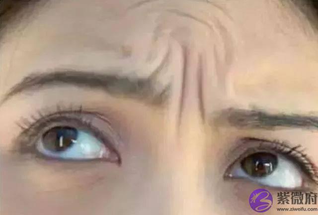 女人额头上长出“三条杠”，你们知道说明什麽吗