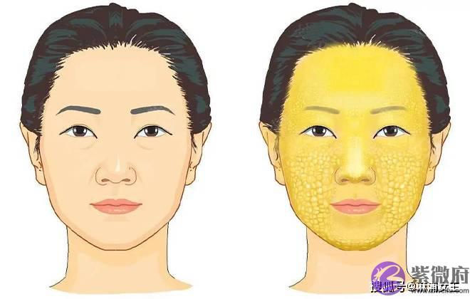 填印第安纹会失败吗？印第安纹怎麽成功去除？