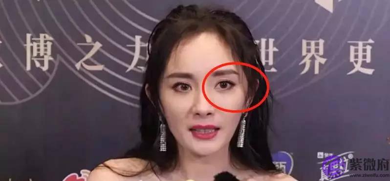 体重自律的杨幂眼部管理怎麽回事？