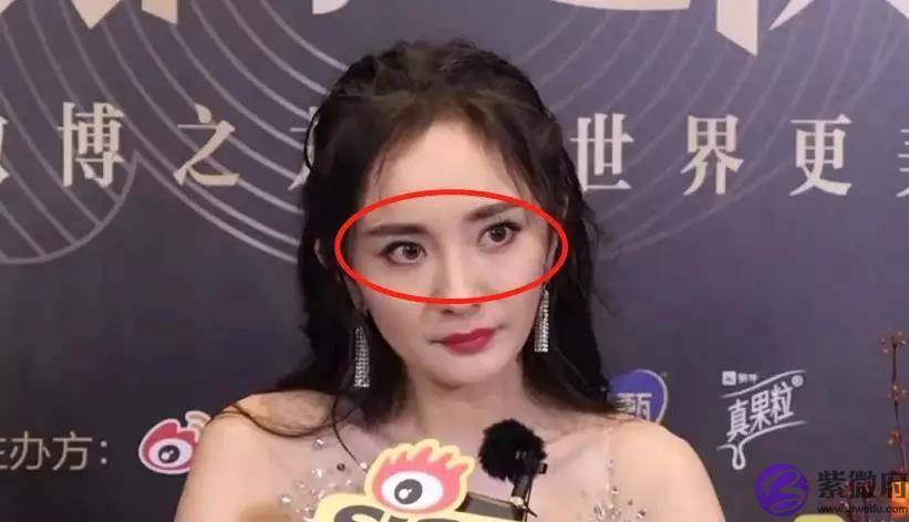 体重自律的杨幂眼部管理怎麽回事？