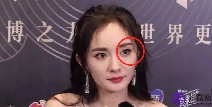 体重自律的杨幂眼部管理怎麽回事？