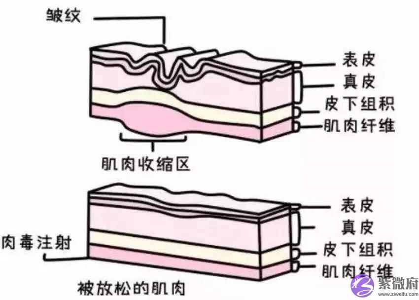 体重自律的杨幂眼部管理怎麽回事？