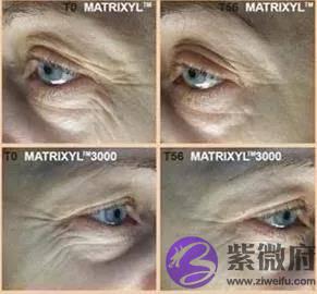 体重自律的杨幂眼部管理怎麽回事？