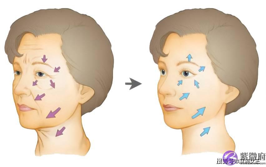 印第安纹在深圳哪里可以解决？印第安纹怎麽去除效果最好？