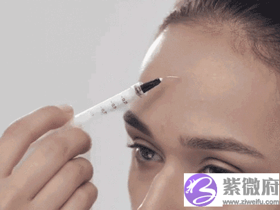 玻尿酸去抬头纹要多少钱