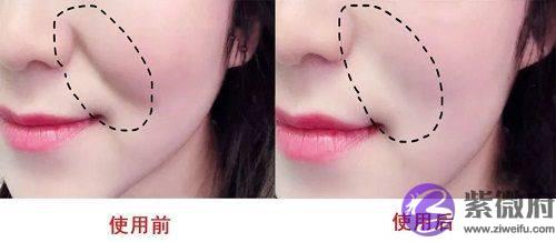 脸上有法令纹怎麽办？不要慌，蔓柚5个妙招帮你去除法令纹