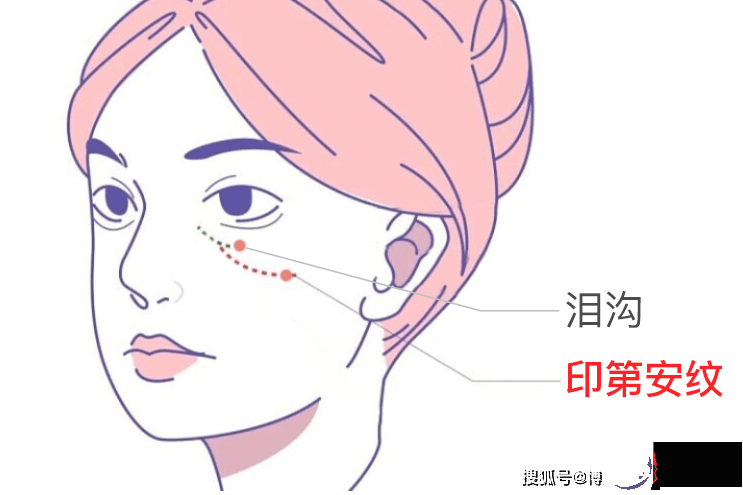 眼睛下面的皱纹是泪沟还是印第安纹？2个方法教你轻松区分泪沟和印第安纹