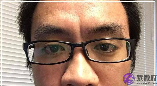 印堂出现了这些纹路，那麽说明这个人气度不凡，一定是好命