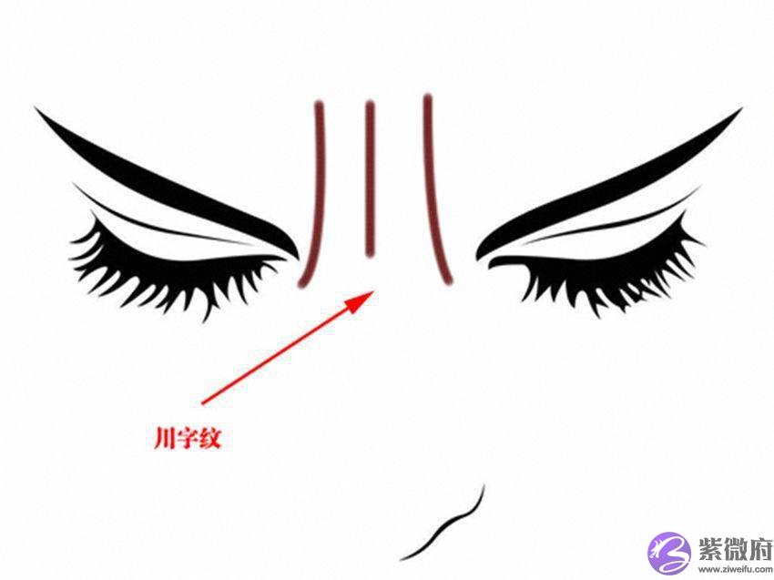 脸上有一纹，可看生死，你知道吗？
