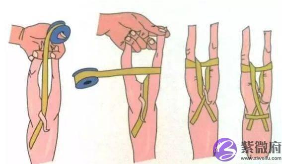 老兽医一招搞定仔猪生辰腿，以后遇见生辰腿小猪不用再淘汰了